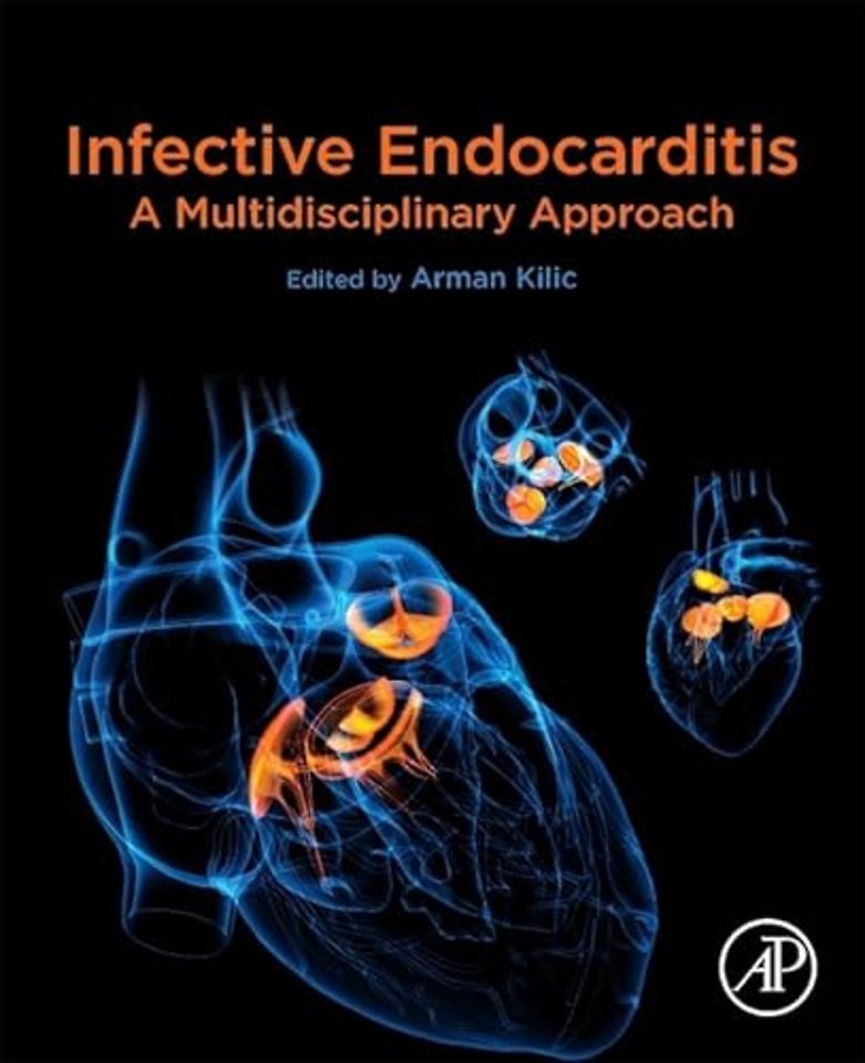 Infective Endocarditis