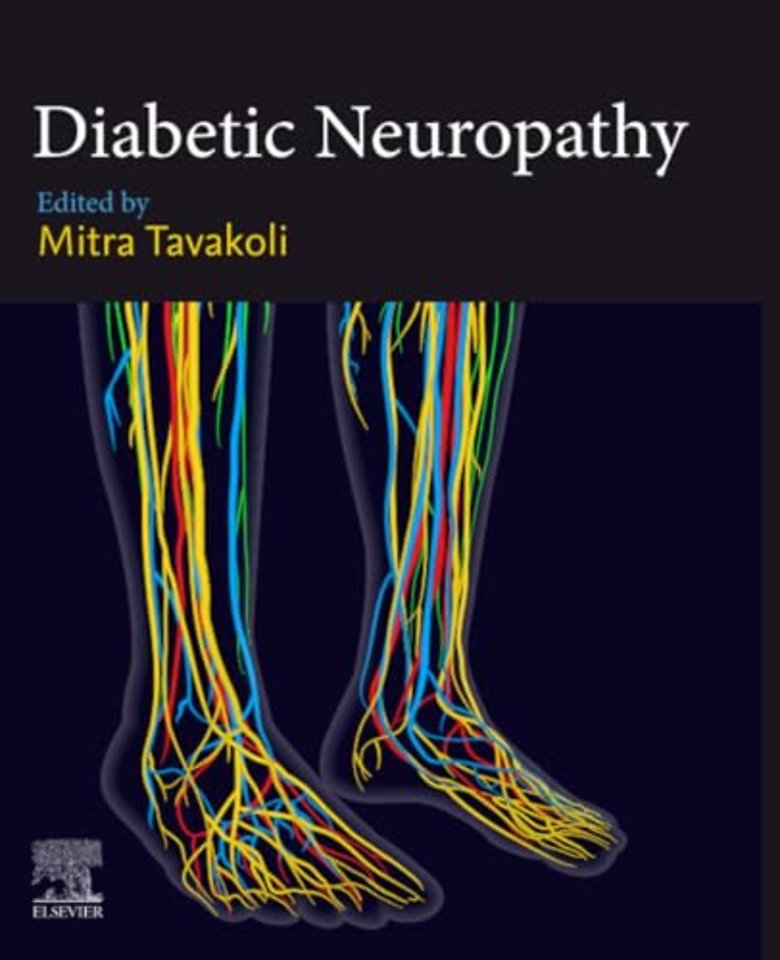 Diabetic Neuropathy