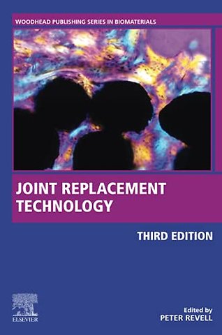 Joint Replacement Technology
