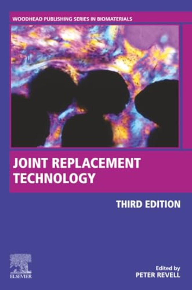 Joint Replacement Technology