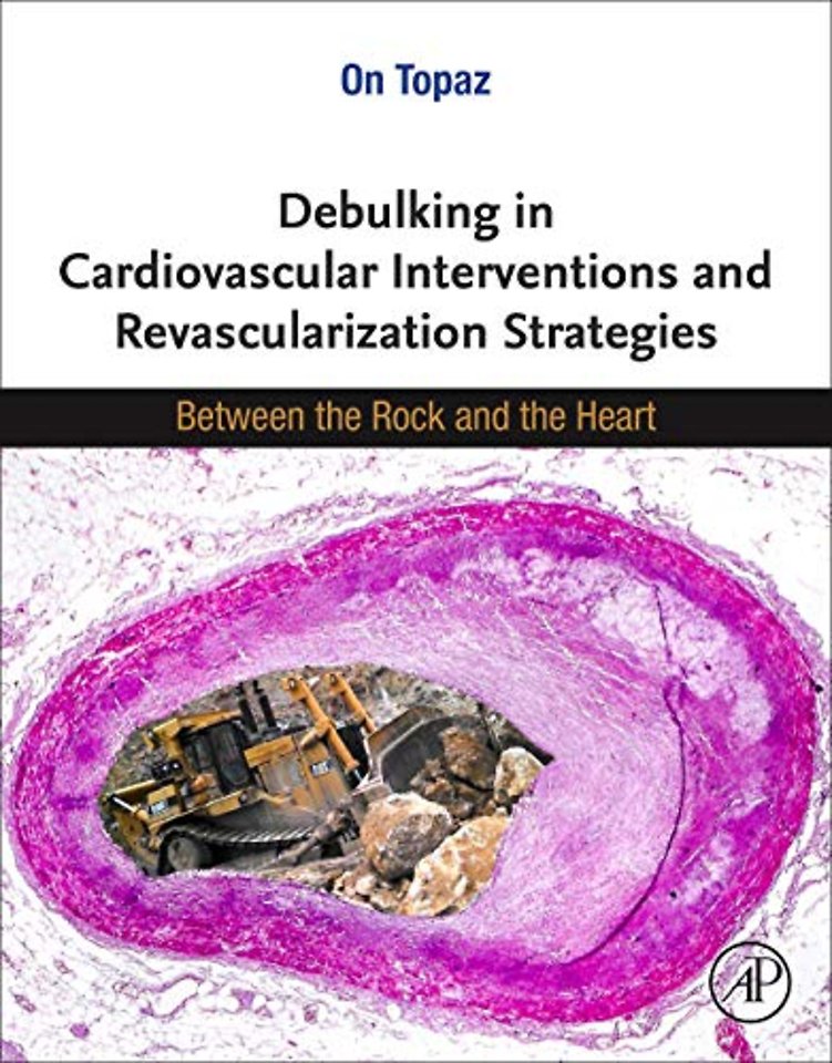 Debulking in Cardiovascular Interventions and Revascularization Strategies