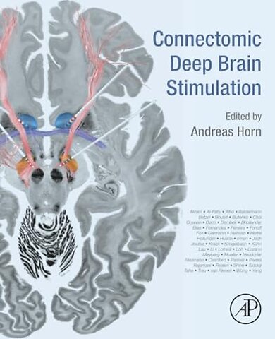 Connectomic Deep Brain Stimulation