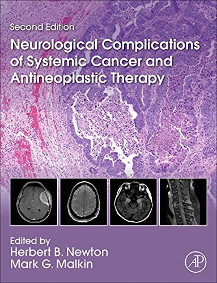 Neurological Complications of Systemic Cancer and Antineoplastic Therapy