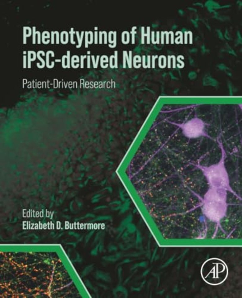Phenotyping of Human iPSC-derived Neurons