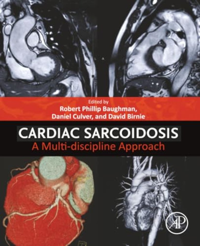 Cardiac Sarcoidosis