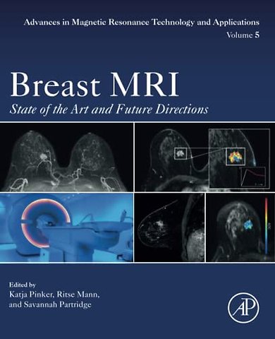 Breast MRI