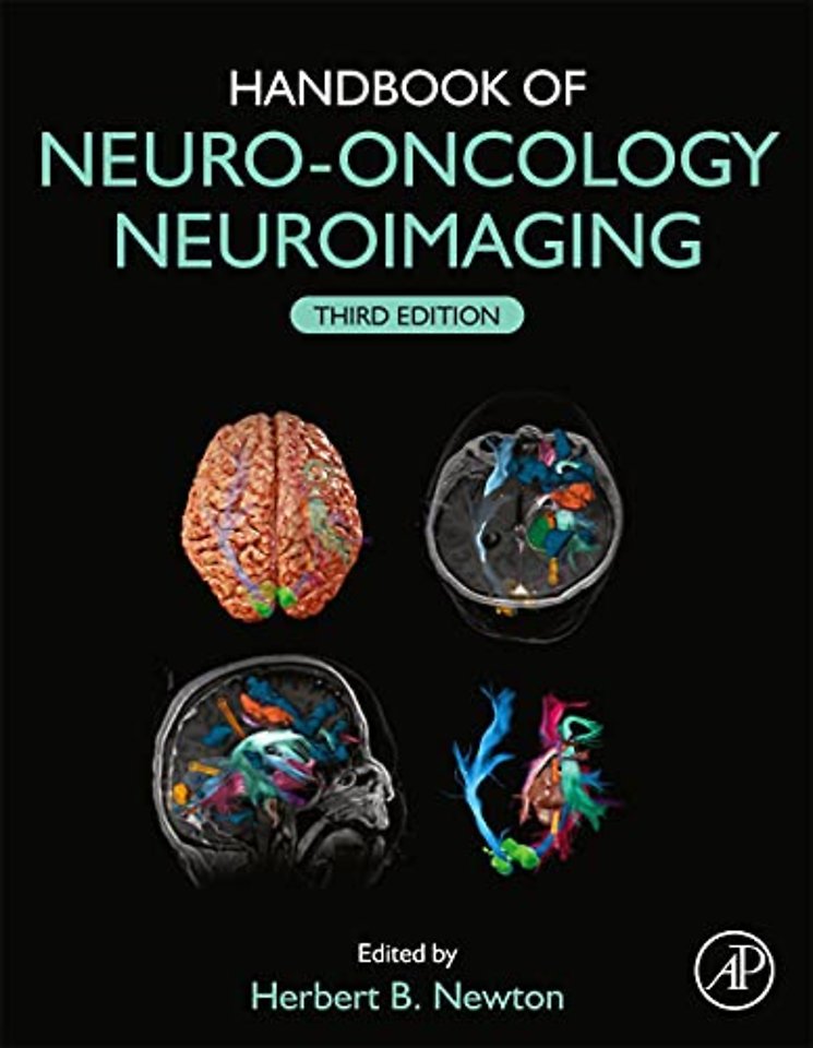 Handbook of Neuro-Oncology Neuroimaging