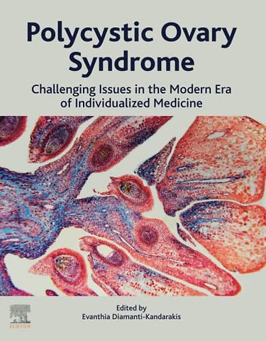 Polycystic Ovary Syndrome