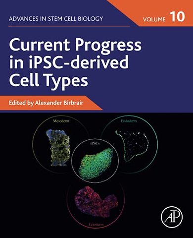 Current Progress in iPSC-derived Cell Types