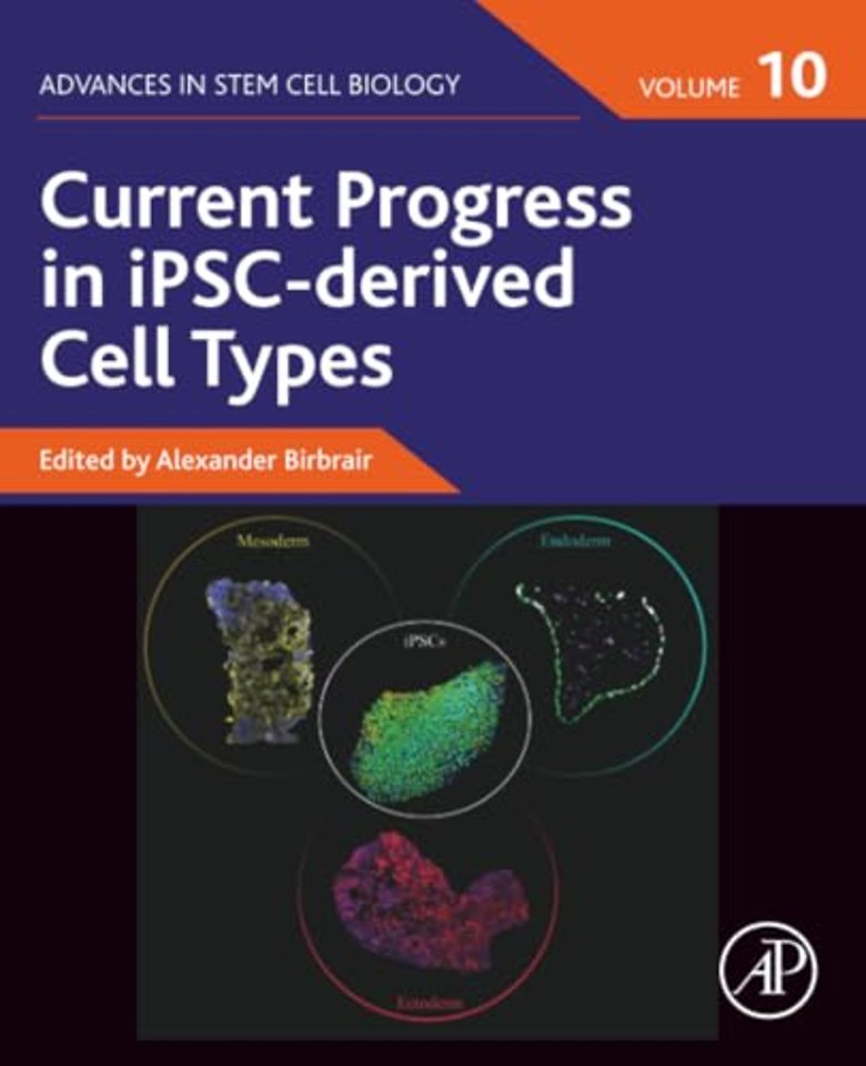 Current Progress in iPSC-derived Cell Types