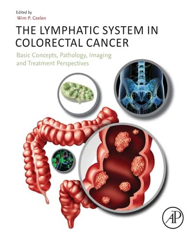 The Lymphatic System in Colorectal Cancer