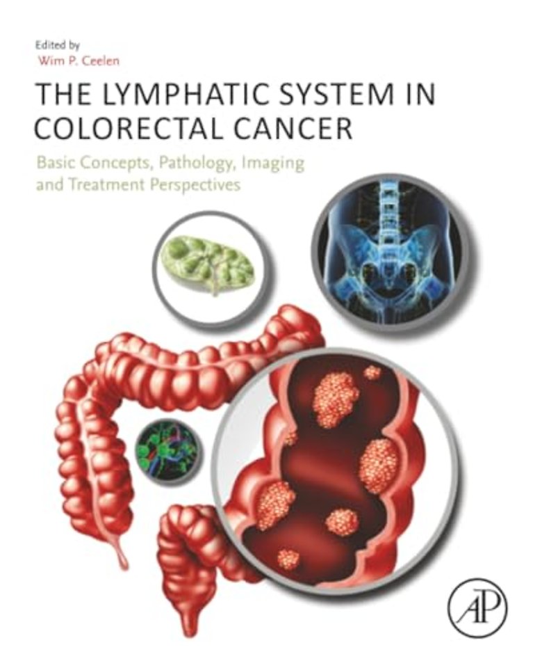 The Lymphatic System in Colorectal Cancer