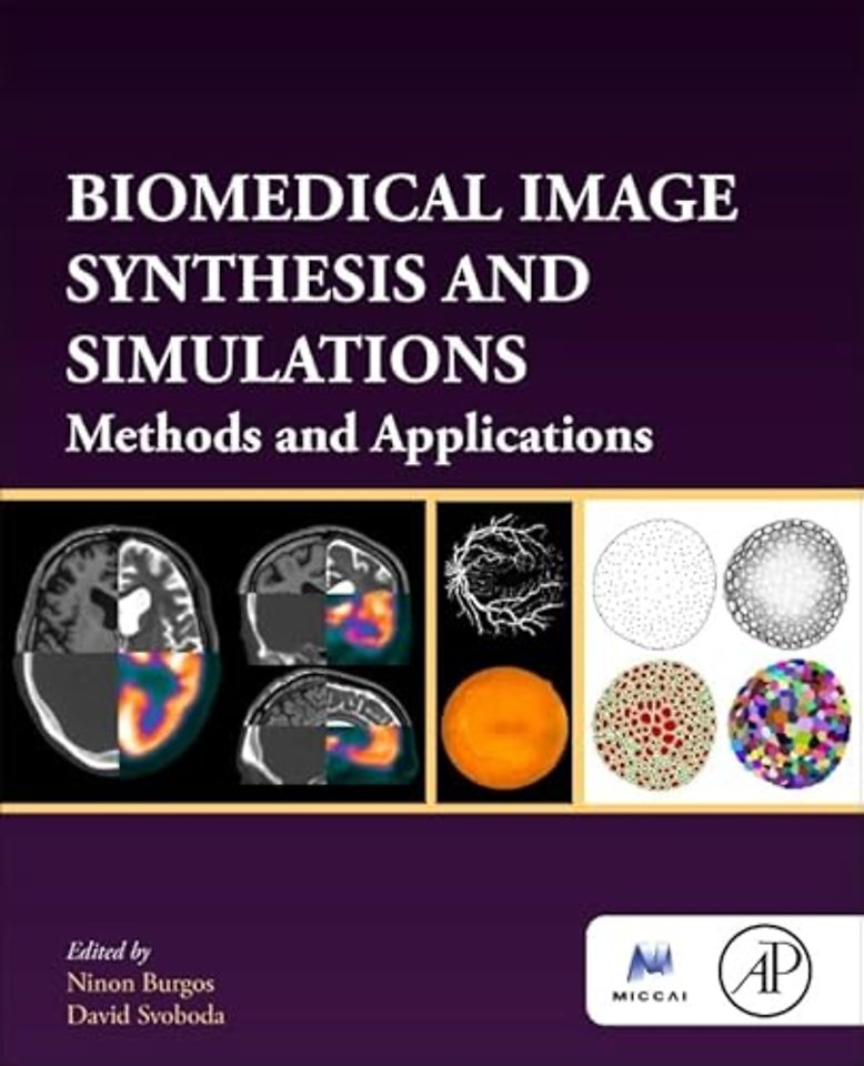 Biomedical Image Synthesis and Simulation