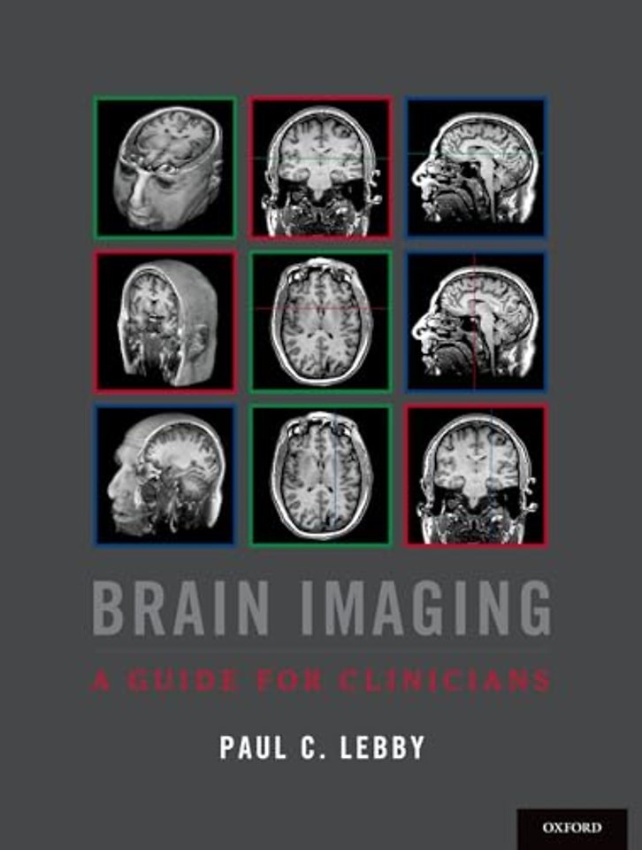 Brain Imaging