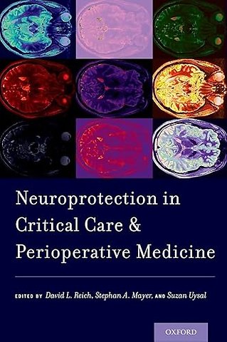 Neuroprotection in Critical Care and Perioperative Medicine