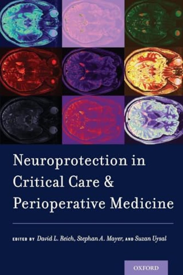 Neuroprotection in Critical Care and Perioperative Medicine