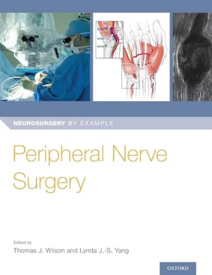 Peripheral Nerve Surgery