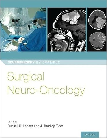 Surgical Neuro-Oncology