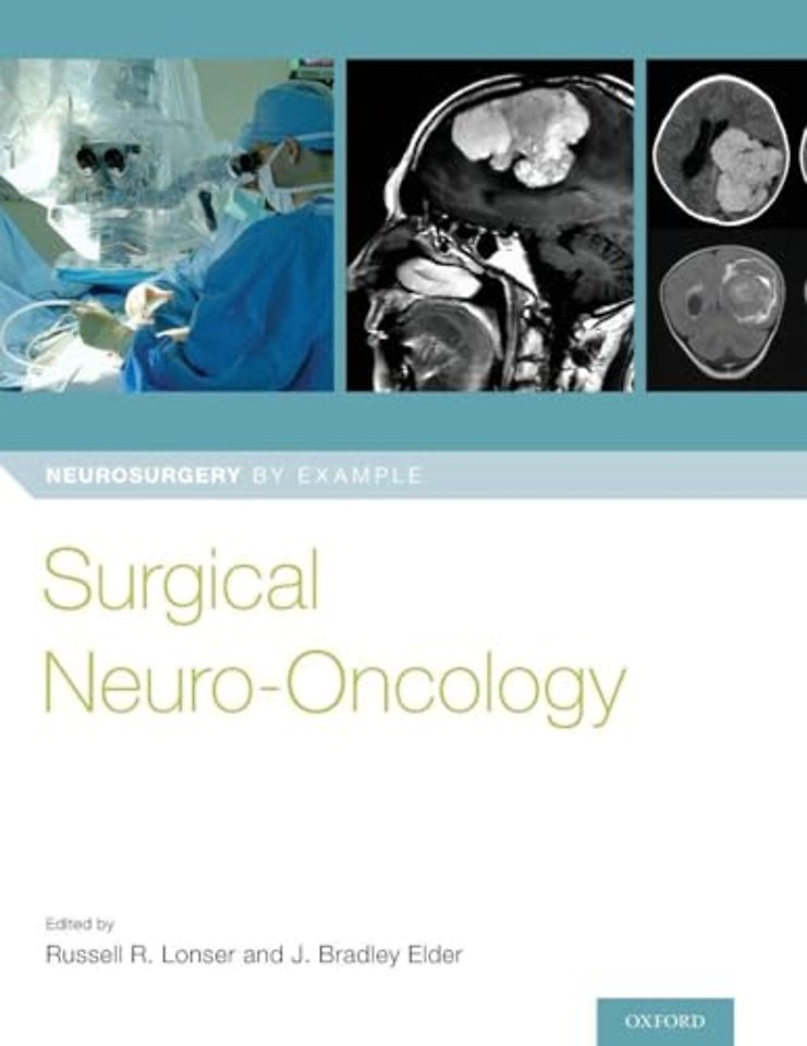 Surgical Neuro-Oncology