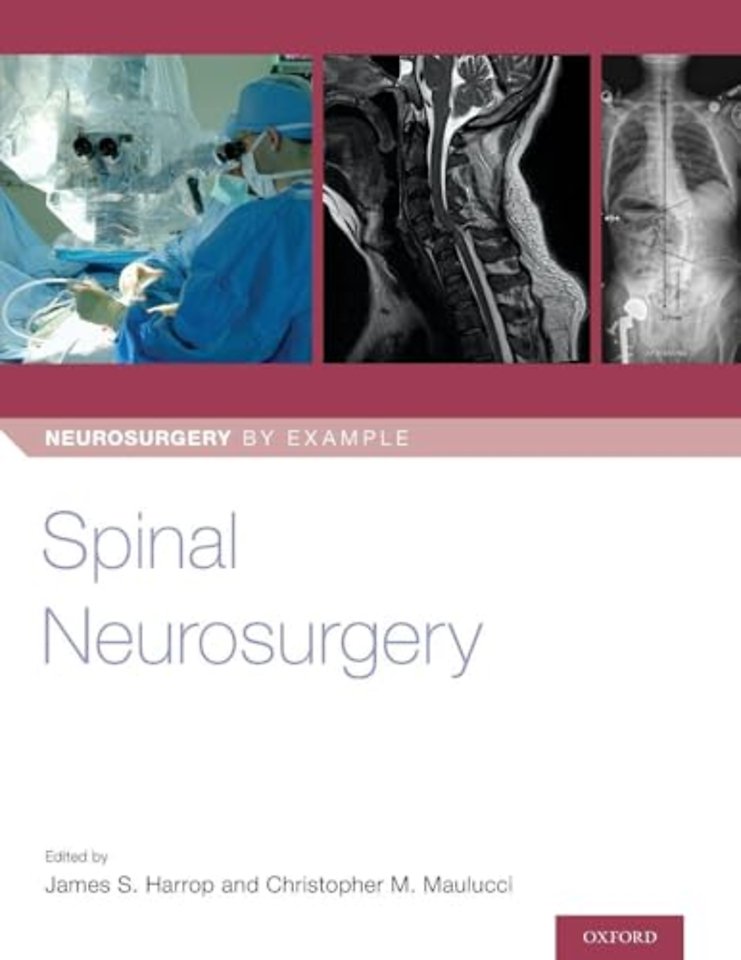Spinal Neurosurgery