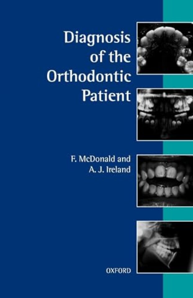 Diagnosis of the Orthodontic Patient