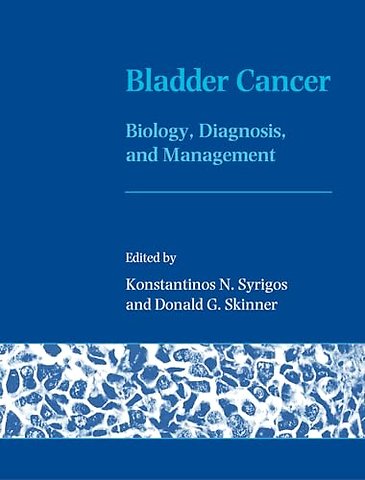 Bladder Cancer