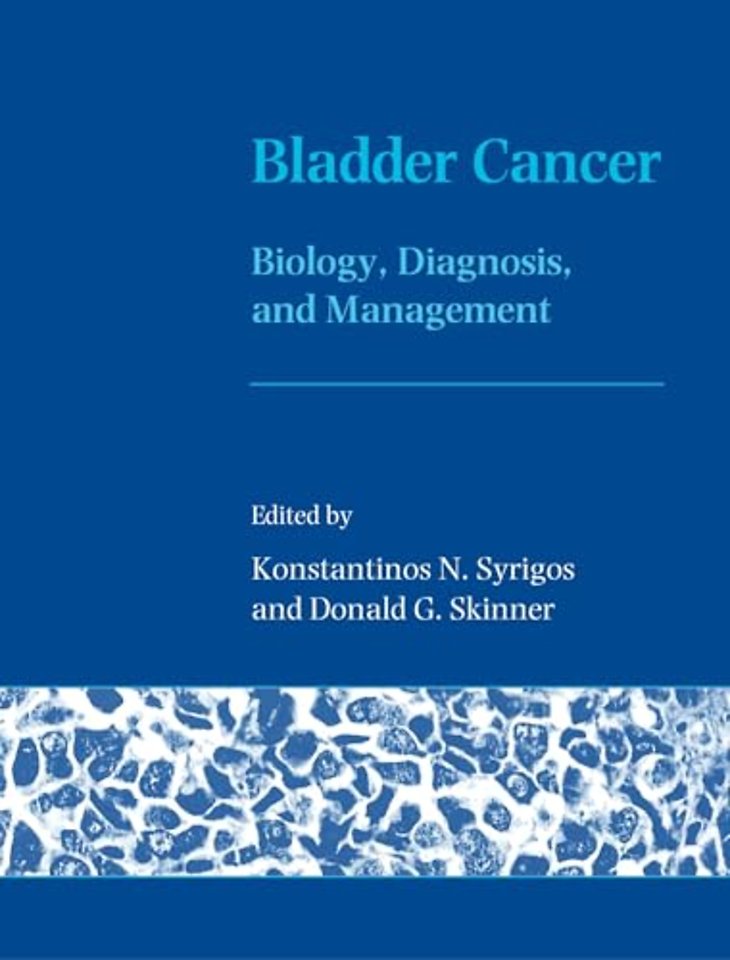 Bladder Cancer