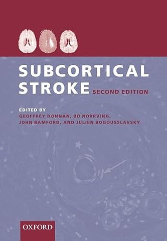 Subcortical Stroke