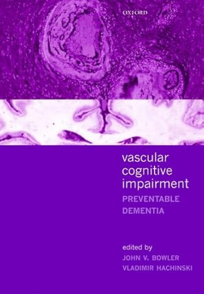 Vascular Cognitive Impairment