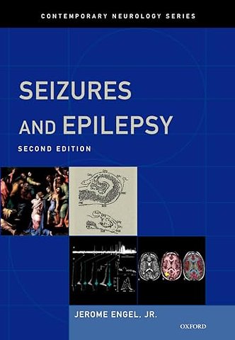 Seizures and Epilepsy