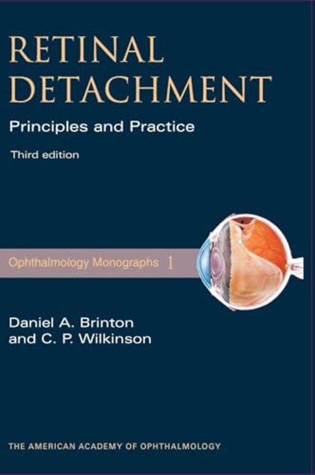 Retinal Detachment