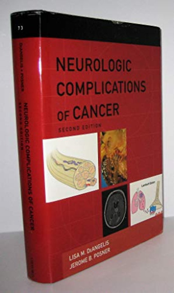 Neurologic Complications of Cancer
