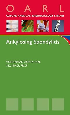 Ankylosing Spondylitis