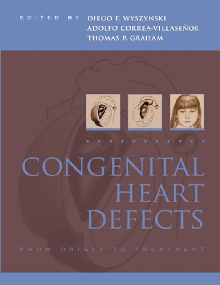 Congenital Heart Defects