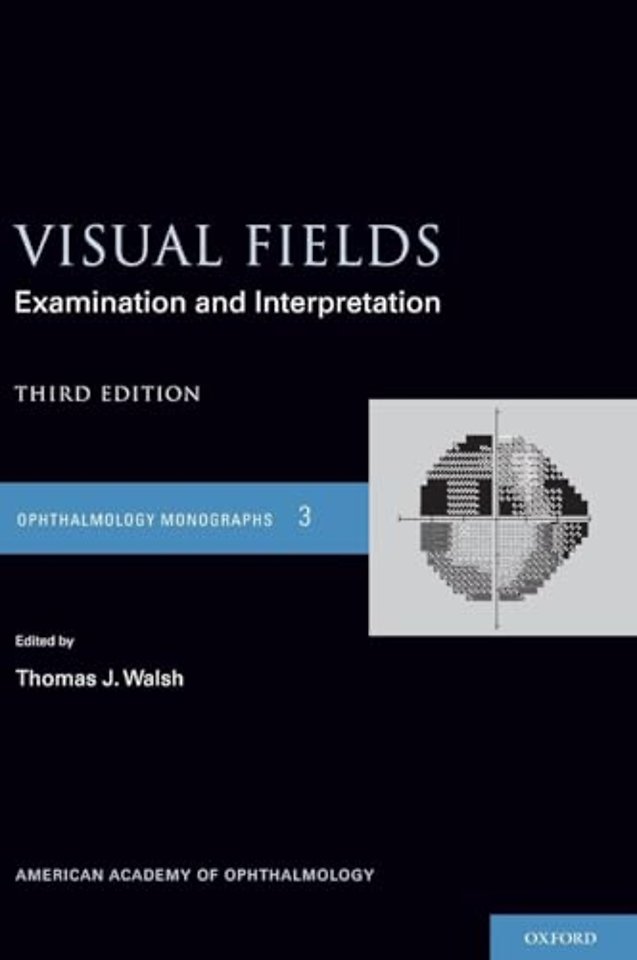 Visual Fields