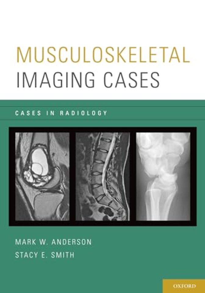 Musculoskeletal Imaging Cases