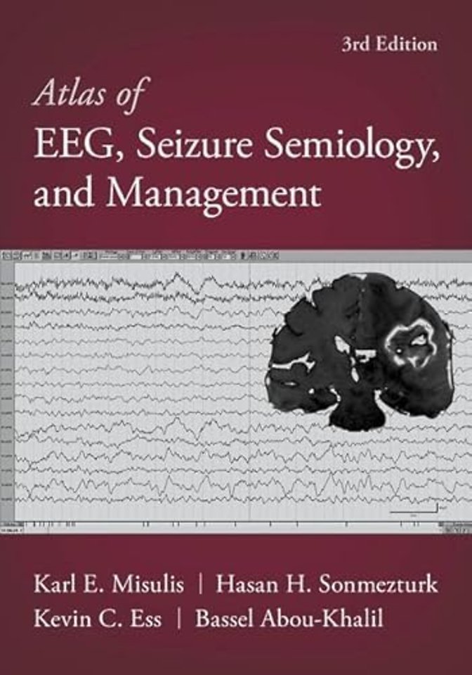 Atlas of EEG, Seizure Semiology, and Management