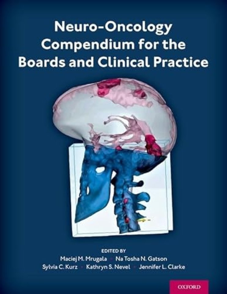 Neuro-Oncology Compendium for the Boards and Clinical Practice
