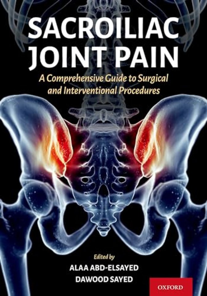 Sacroiliac Joint Pain