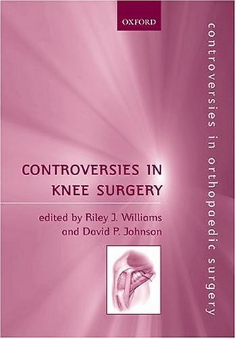Controversies in Knee Surgery
