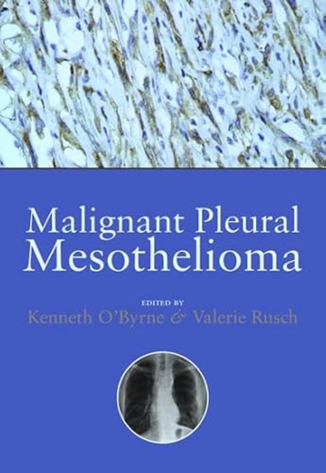 Malignant Pleural Mesothelioma