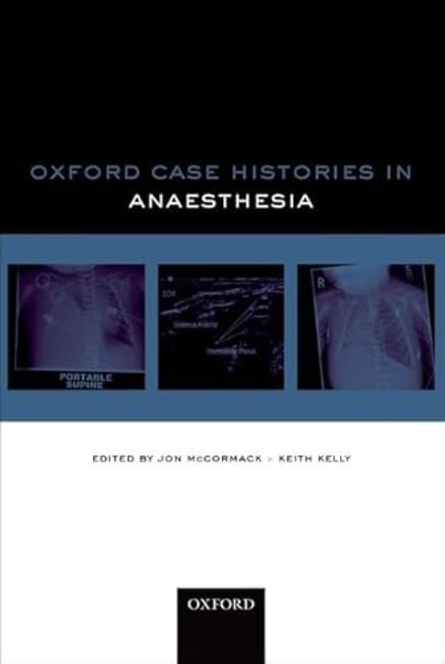 Oxford Case Histories in Anaesthesia