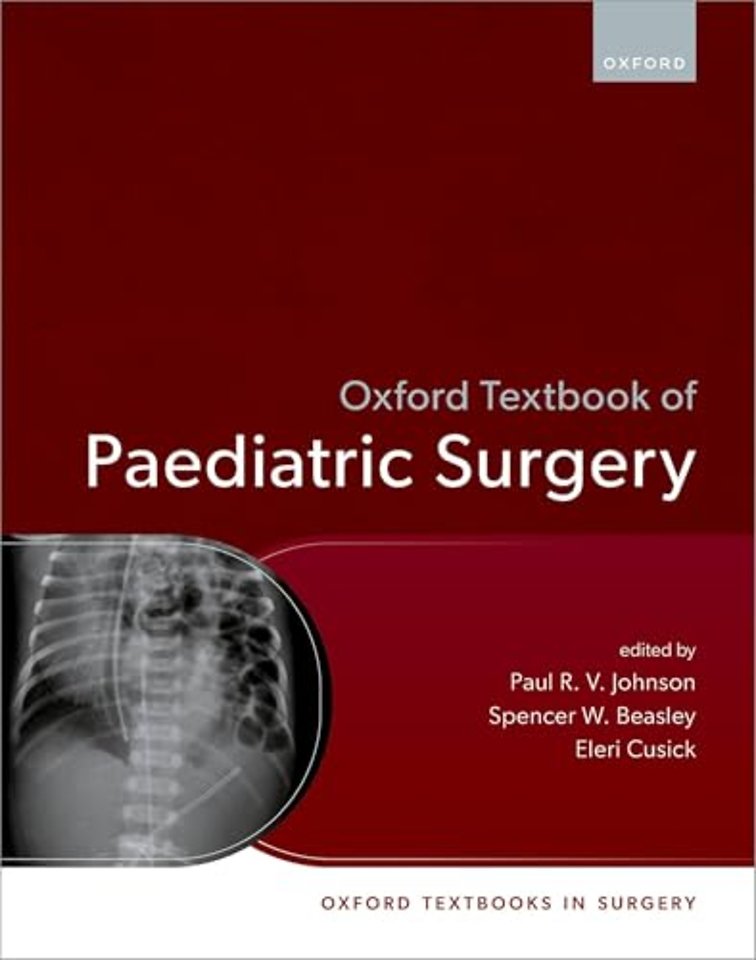 Oxford Textbook of Paediatric Surgery
