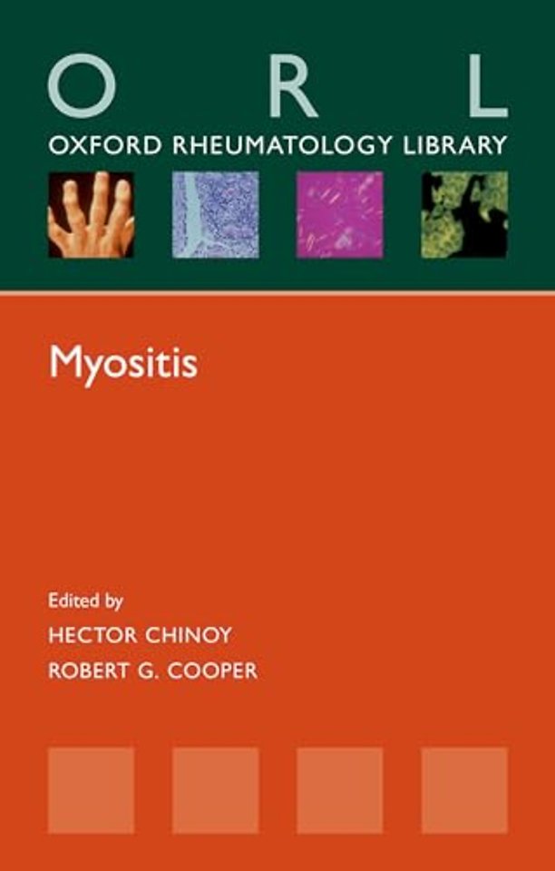Myositis