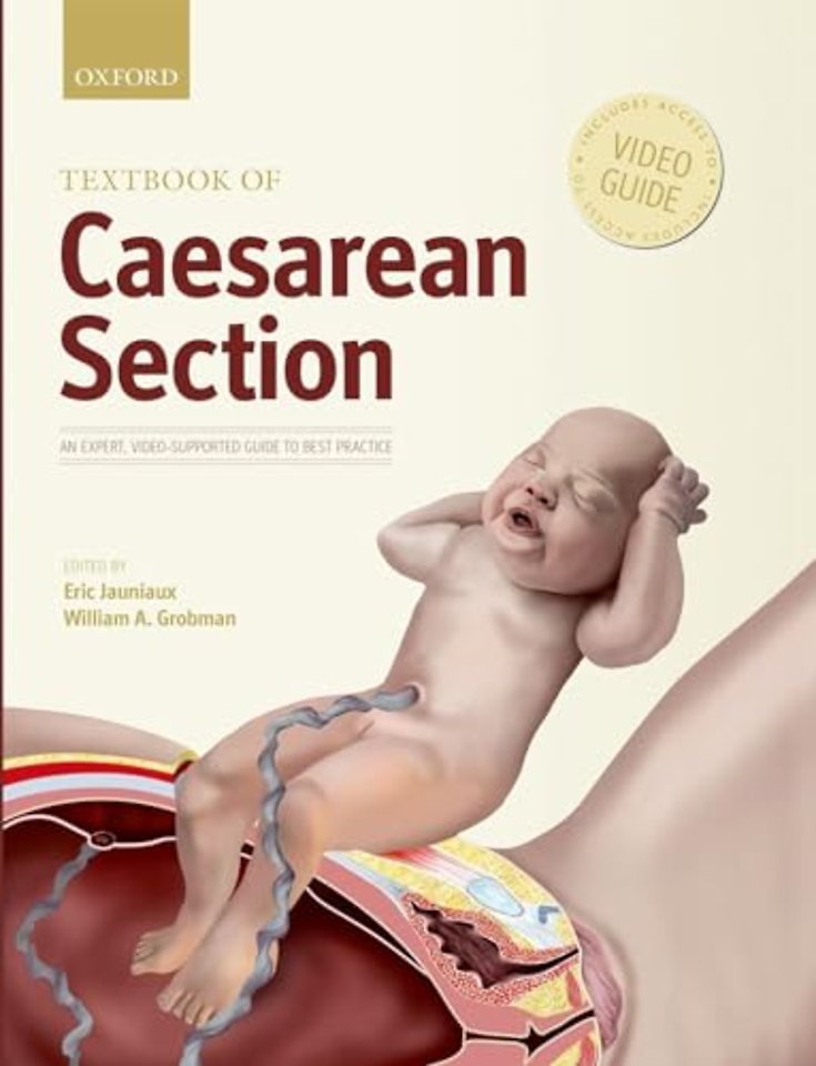 Textbook of Caesarean Section