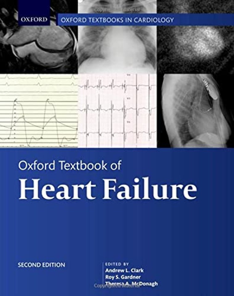 Oxford Textbook of Heart Failure