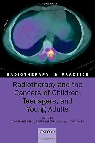 Radiotherapy and the Cancers of Children, Teenagers, and Young Adults