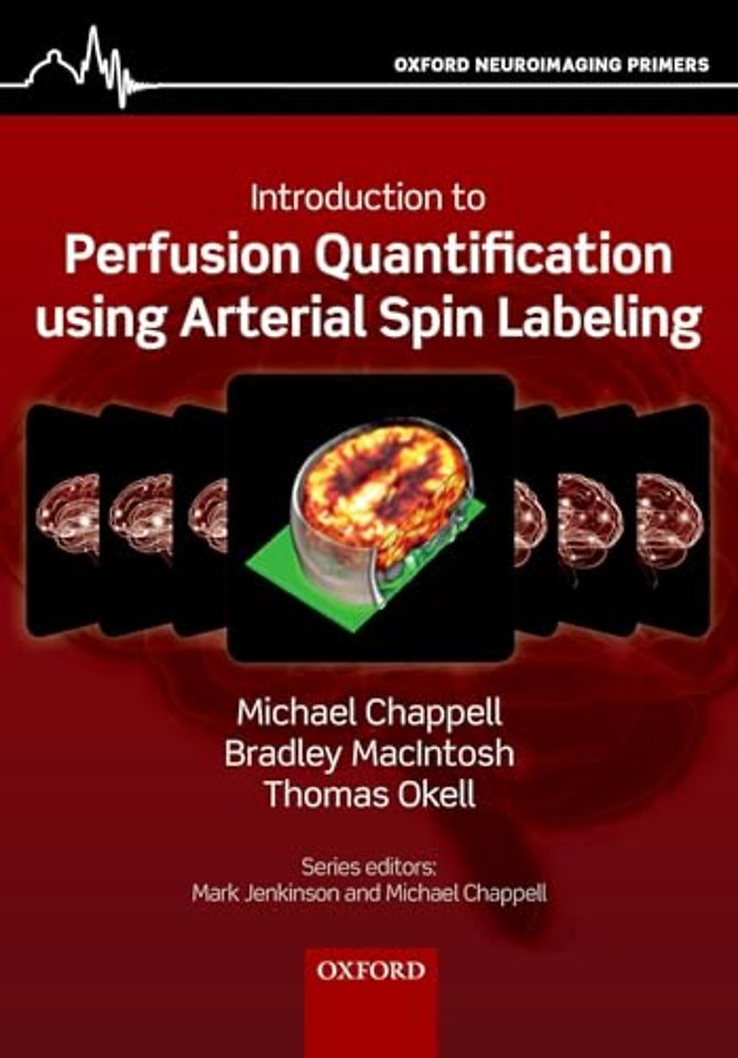 Introduction to Perfusion Quantification using Arterial Spin Labelling