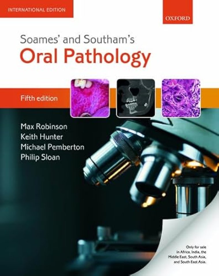 Soames' & Southam's Oral Pathology