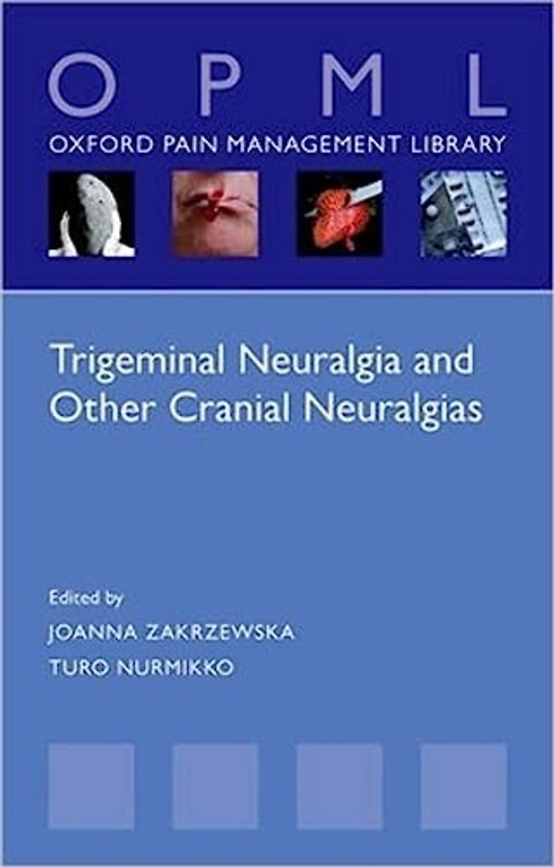 Trigeminal Neuralgia and Other Cranial Neuralgias